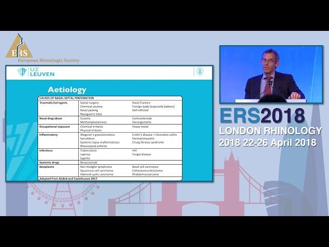 ERS London 2018, M Jorisen, How I Do It - Management Of Septal Perforation