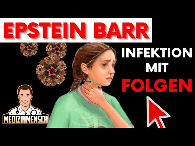 Epstein Barr Virus: Die Immunologischen Folgen EBV Infektion (wissenschaftlich erklärt)