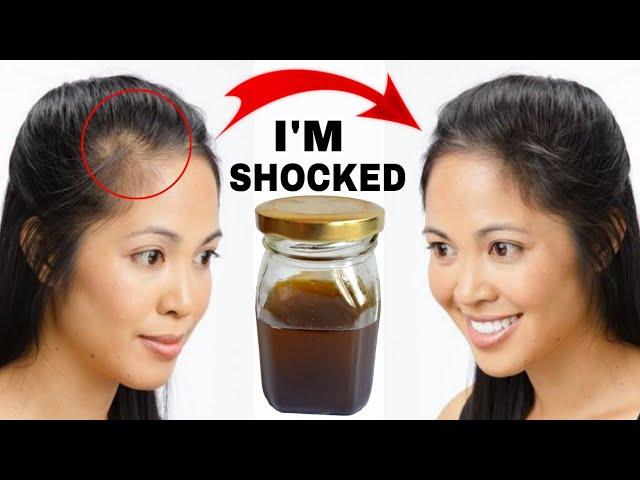 Hair Tonic To Increase Thickness And Volume Of Your Hair Naturally