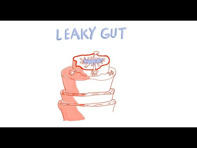 What is Leaky Gut and How to Manage It?