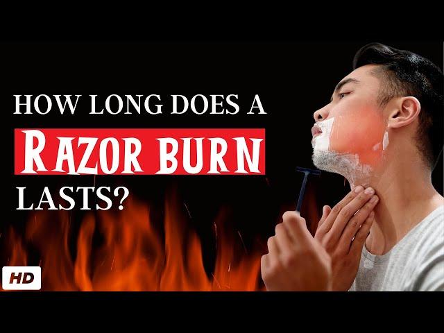 how Long Does A Razor Burn Or Bump Last