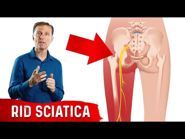 5 Herbal Remedies for Sciatica