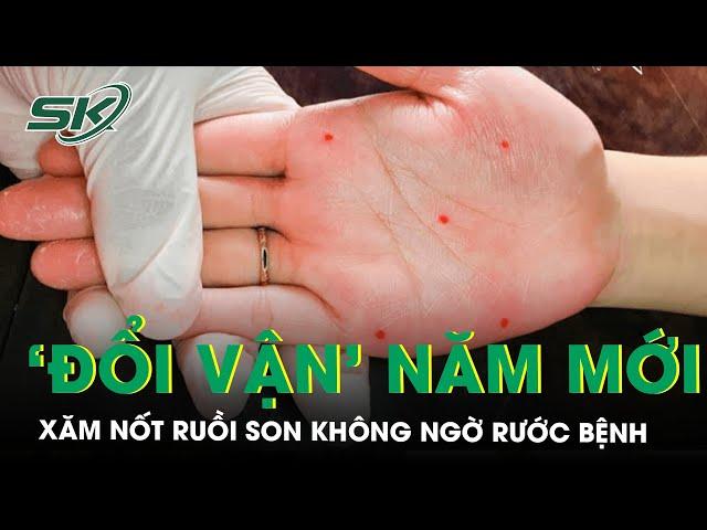 Xăm nốt ruồi son đổi vận: Vận chưa đổi đã rước thêm bệnh | SKĐS