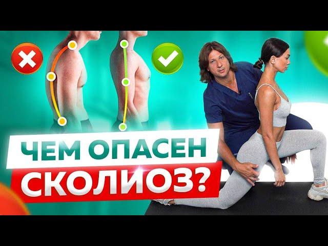 Что начать делать при сколиозе или кифозе? 7 упражнений для лечения позвоночника