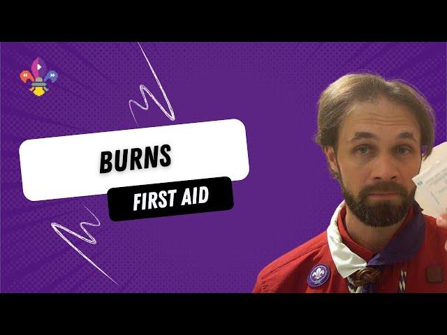 Help with Burns? | SCOUTADELIC #Scoutdoors