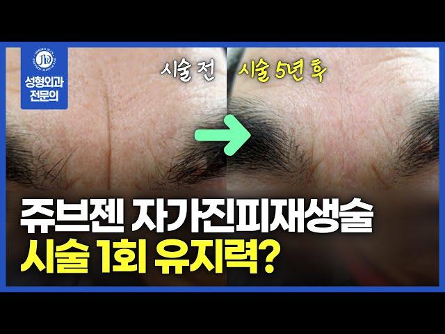 쥬브젠 자가진피재생술, '시술 1회'에 유지력이 이 정도라고?