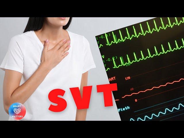 Supraventricular Tachycardia | SVT