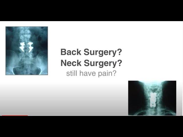 Post Back Surgery / Continued Pain Patients Hope with Chiropractic Cox Technic