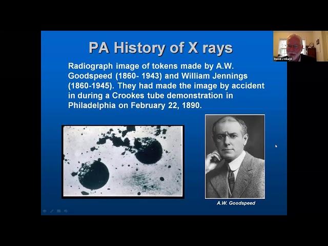 X-Rays at 125 Years: The Story of a Serendipitous Discovery Through Diligent Development