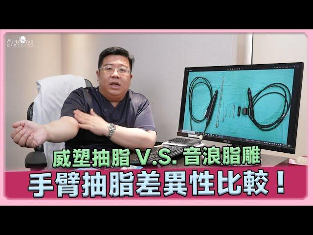 抽脂比一比! 威塑抽脂 vs 音浪脂雕 探索手臂抽脂的差異｜林敬鈞醫師｜巨星整形外科