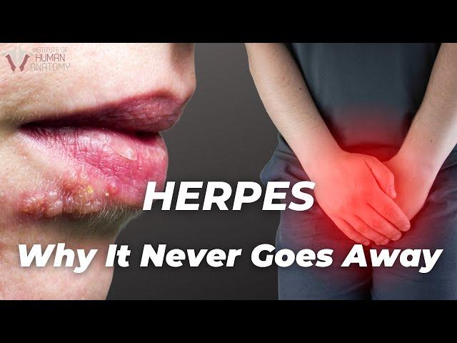 Why Herpes never goes away | The Institute of Human Anatomy