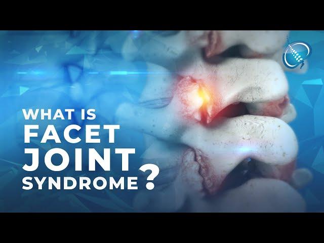 What is Facet Joint Syndrome?