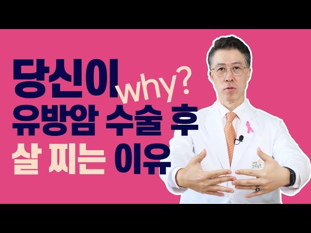 유방암 수술 후 왜 살이 찔까?