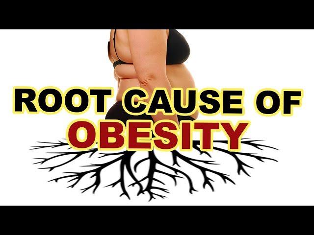 Insulin Resistance Explained | Eradicate the root cause of obesity and diabetes!