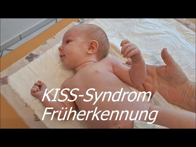 KISS Syndrom: Früherkennung bei Babys von Geburt an.