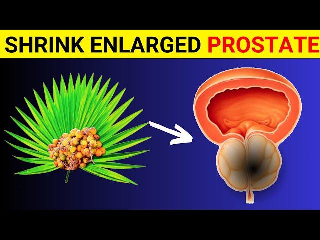 Natural remedies for an enlarged prostate
