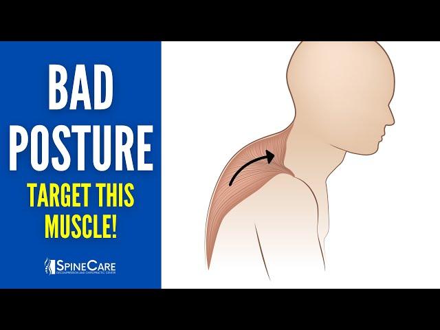 Quickly Fix Bad Posture (By Releasing This Tight Muscle)