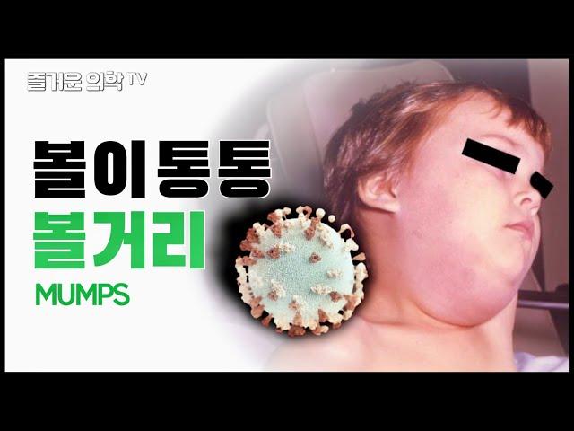 볼거리(유행성이하선염)에 걸리면 귀가 멀 수도 있습니다. Mumps [feat. 닥터X]