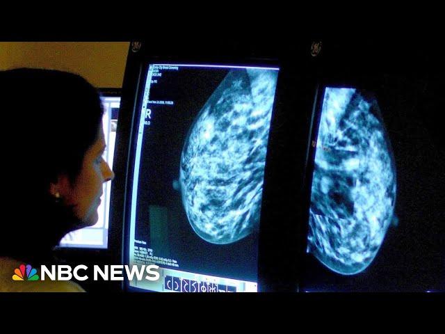 American Cancer Society report finds rise in breast cancer cases in younger women