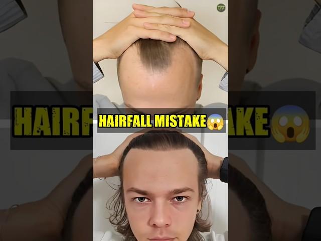  Biggest Hair fall Mistakes | #shorts #mensfasion #hairfall