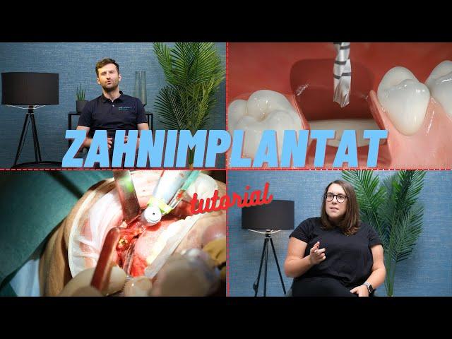 Zahnimplantat einsetzen | Wie funktioniert das in der Praxis?