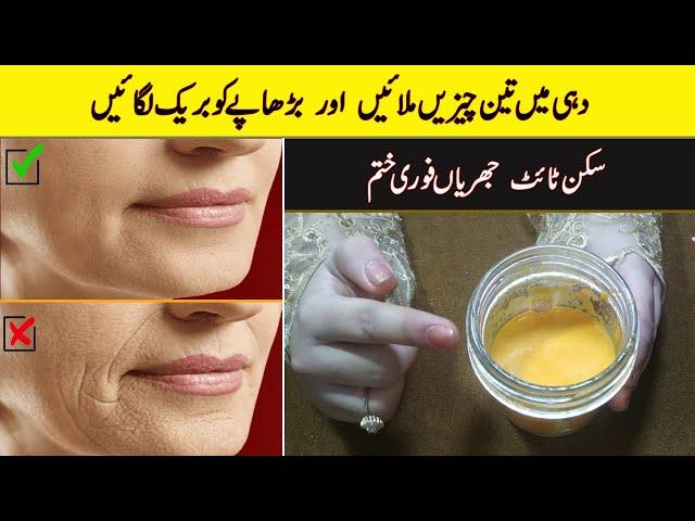 Instant Skin Tightening  Home Remedy / Skin Lifting Treatment In Urdu // Skin Tight Karne Ka Tarika