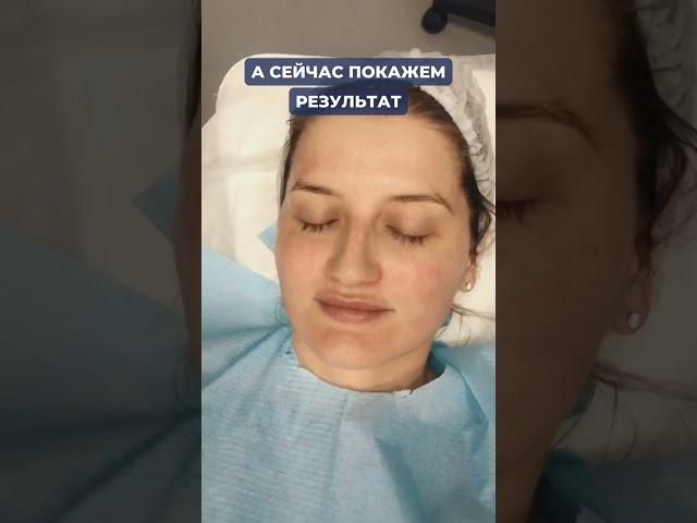 Наши результаты после процедур! Хотите также? Приходите в центр красоты и здоровья "Этика"