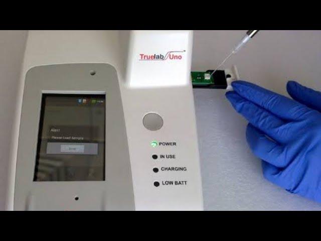 TRUE NAT TEST FOR MTB,CBNAAT test,truenat test for micobacterium tuberculosis#viral #drnajeeb#health