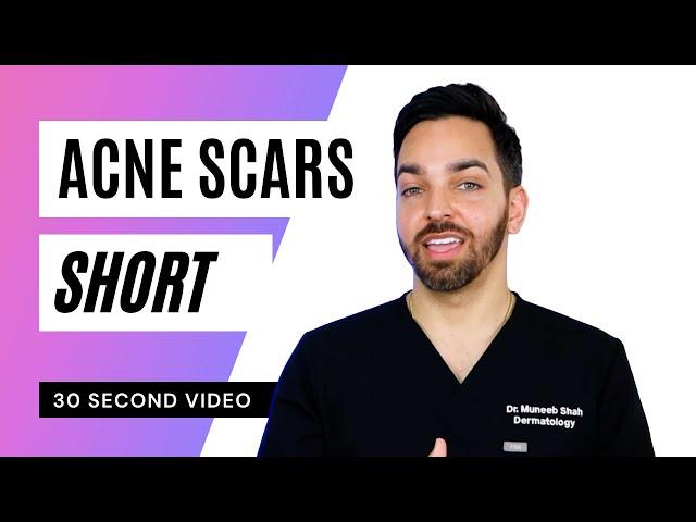 Acne Scars #shorts