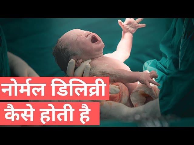 Normal Delivery Kaise Hoti Hai | Normal Delivery In Jaipur | Dr. Mayuri Kothiwala
