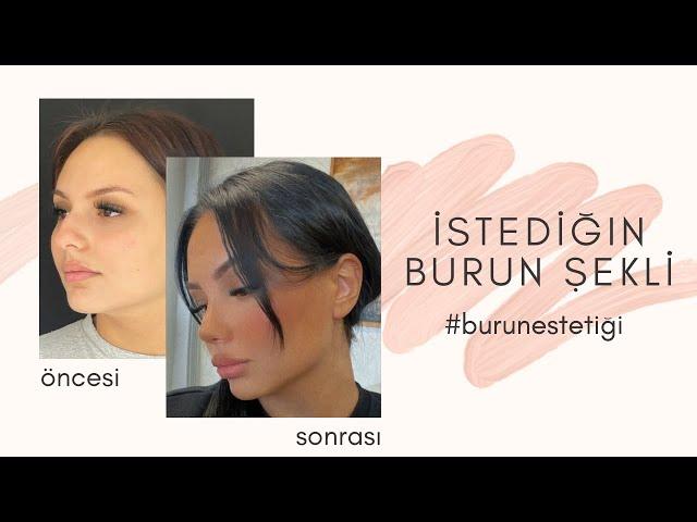 İstediğin Burun Mümkün | Güray Yeşiladalı #rhinoplasty #gürayyeşiladalı