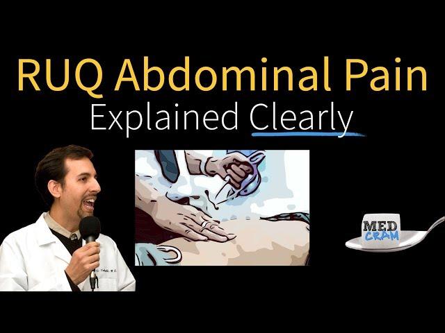 Abdominal Pain Explained Clearly - Right Upper Quadrant