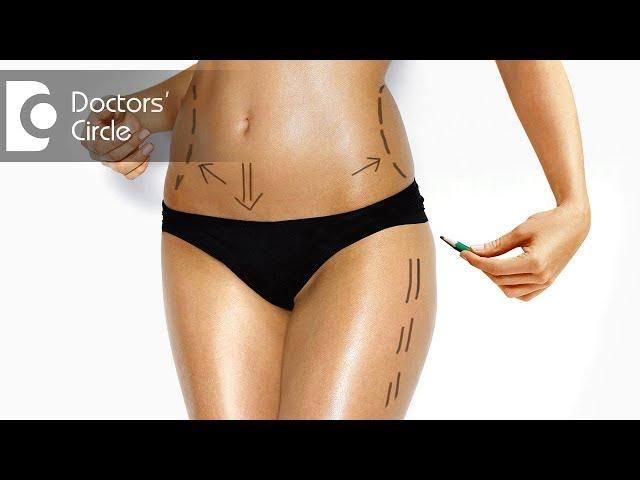 Advantages of Power Assisted over Regular Mechanical Liposuction - Dr. Girish A C | Doctors' Circle