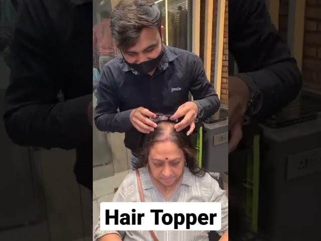 BEST HAIR TOPPER FOR HAIR THINNING | HAIR TOPPER INDIA | BALDNESS TREATMENT | HUMAN HAIR SILK TOPPER