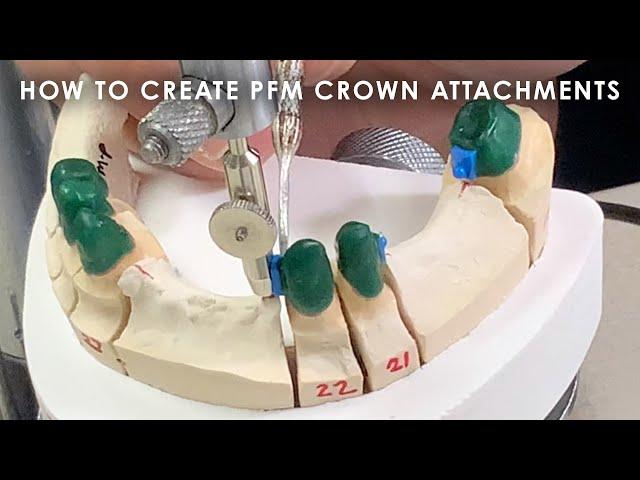 How to create PFM Crown Attachments