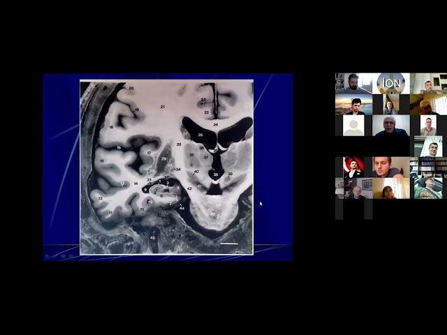 İON 125. Lecture, Erdem: Medial Temporal Lobun Mikronöroanatomik Detayları ve Hippokampektomi Tek.