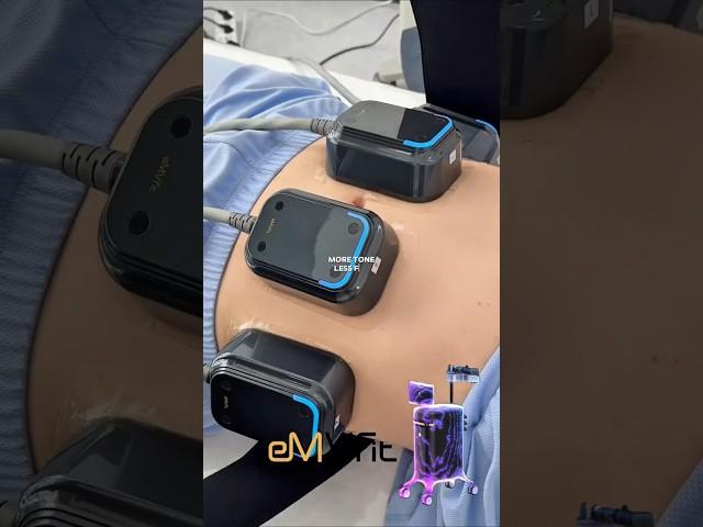 뱃살 다이어트 최신 트렌드 #뱃살운동 #다이어트브이로그