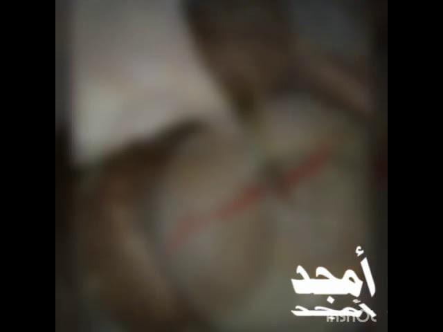 مطبخ أم امجد الخالي من الغلوتين.