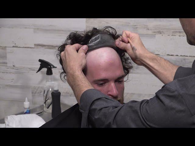 Part 1 Non-surgical hair replacement. Installing a hair system beginning to end #1 of 4