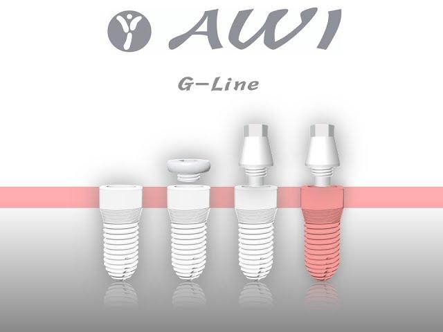 AWI Keramikimplantate G-Line Implantat mit internem Sinuslift