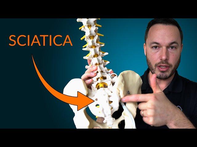 Understanding Sciatica- Everything you need to know about the causes and treatment of sciatica.