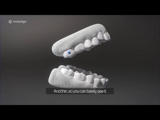 Schneekluth Orthodontics Providing Invisalign to patients in Garden Grove CA