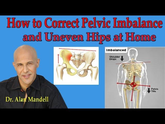 How To Correct Pelvic Imbalance and Uneven Hips at Home - Dr Mandell