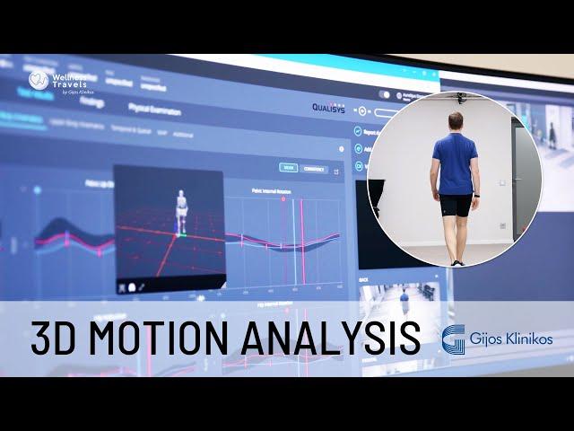 3D motion analysis at Gijos Klinikos