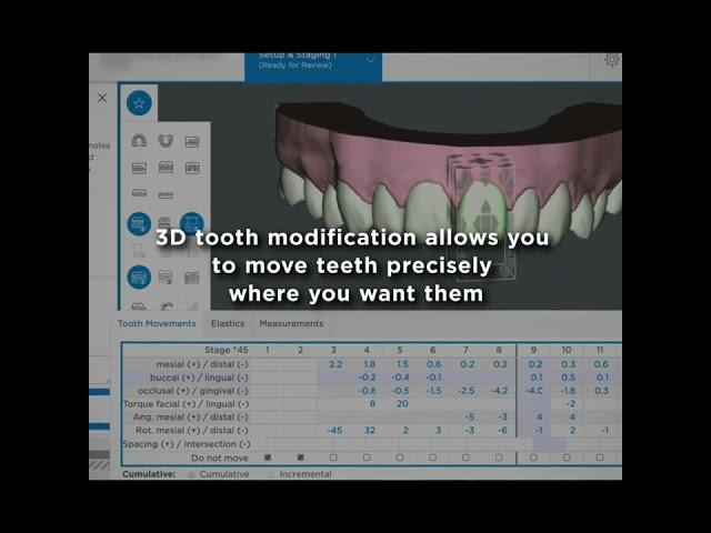 SureSmile software oktober 2022