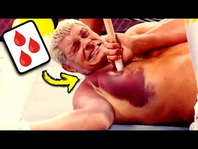 Doctor Reacts To Painful WWE Injuries