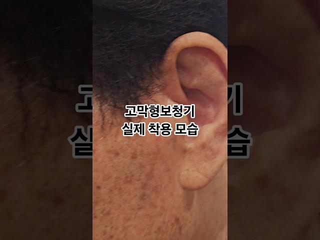 고막형보청기 실제 착용모습#보청기가격 #포낙보청기