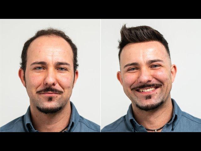 New Hair Replacement: natureLine Swiss Lace | Transformation with Hairsystem | Hairsystems Heydecke