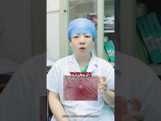 有性生活的女性床头必备这三种药#苦参膜 #妇科 #安心膜陪伴女性健康 #医学科普 #硬核健康科普行动