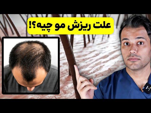 5 علت ریزش مو چیه و چجوری درمان میشه؟